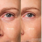 ABEILLE ROYALE SOINS YEUX REPARATEUR JEUNESSE POT 15ML